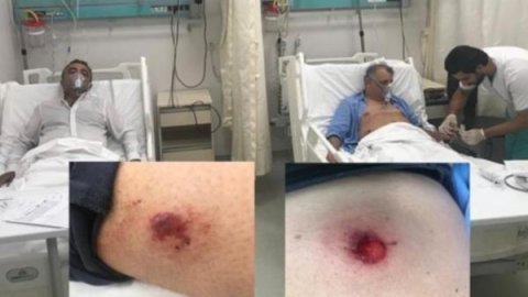 Kadıköy'deki Suruç anmasına polis müdahalesi: Milletvekilleri yaralandı, gözaltılar var