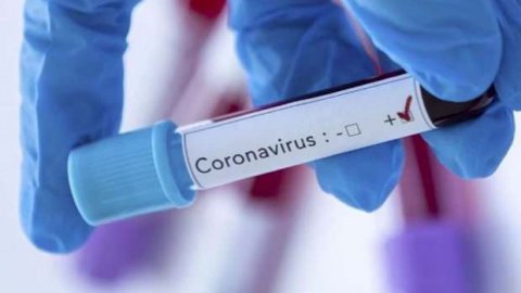 Koronavirüs haberine iki gözaltı!