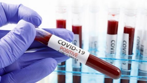 Silivri Cezaevi'nde 82 koronavirüs vakası