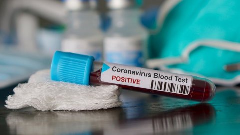 2 stajyer doktorun koronavirüs testi pozitif çıktı