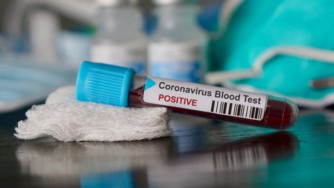 Koronavirüs testinde 6 gün uyarısı