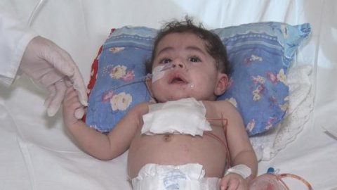 Dünyada 33, Türkiye’de 2'nci vaka... 5 aylık bebeğin kalbine Türk doktordan 'zırh'
