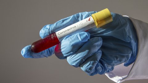 Koronavirüs belirtileri olsa da test sonucu negatif! Prof. Dr. Şenol açıkladı! İşte sebebi…