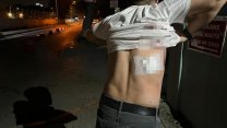 İzmir'de bir taksici saldırısı daha: Makasla yaraladılar!